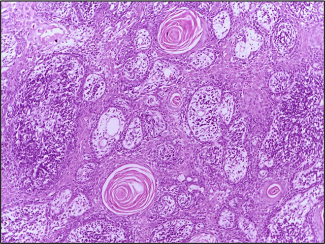 Genetics of skin disease